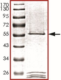 Sino Biological&nbsp;Recombinant Human AURKC/Aurora C Protein (Full Length, GST Tag)